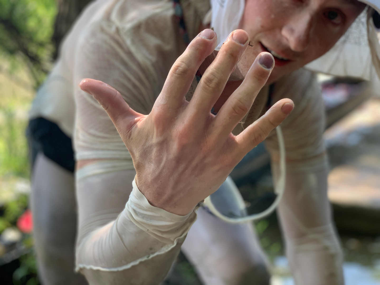 Missing fingernails at Victoria.